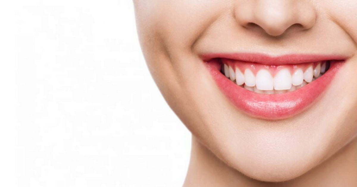 sorriso gengivale prima e dopo
